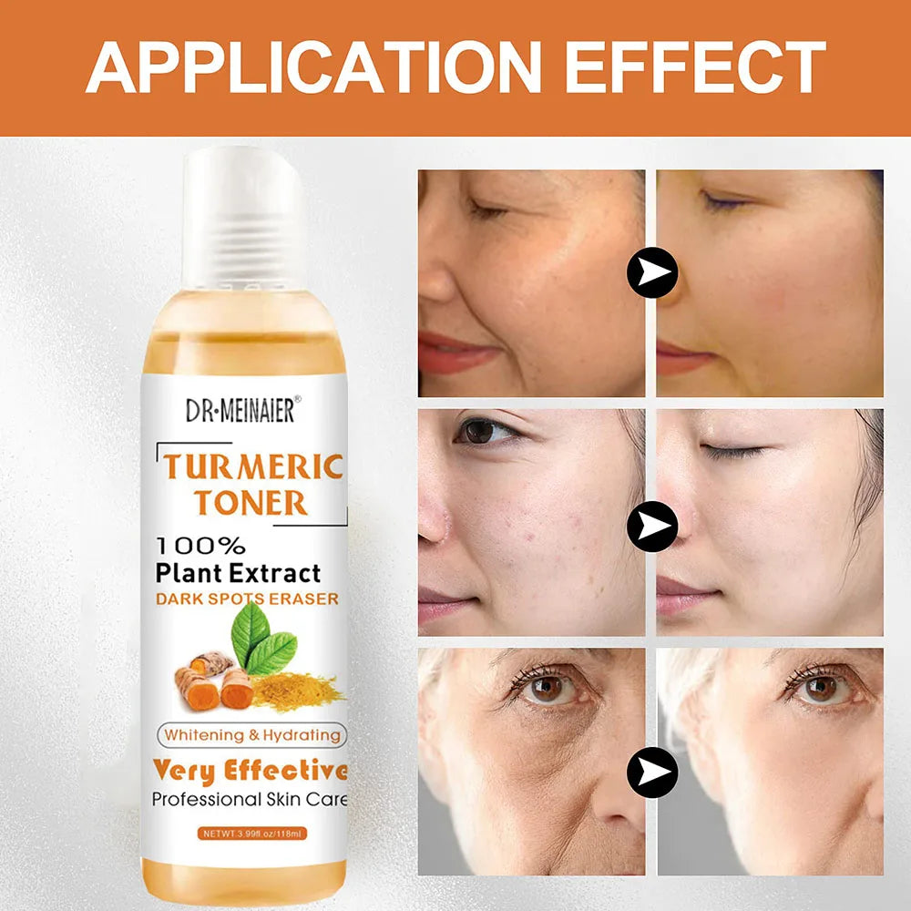 2Pcs Tumeric Dark Spots Toner Spots Eraser Corrector Turmeric Fade Blemishes Dark Spot Remover Acne Remover Toner for Dark Skin